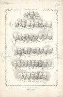 Matthias Rudolf Toma – Messerschmidtove charakterové hlavy 