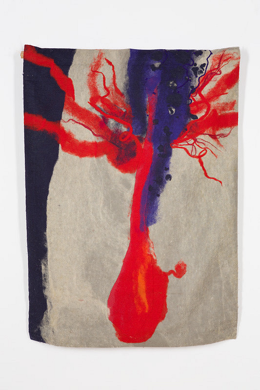 Peter Günther – Anxiety 